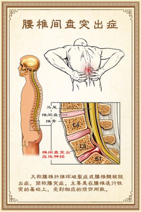 中医海报腰间盘突出