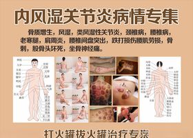 拔火罐