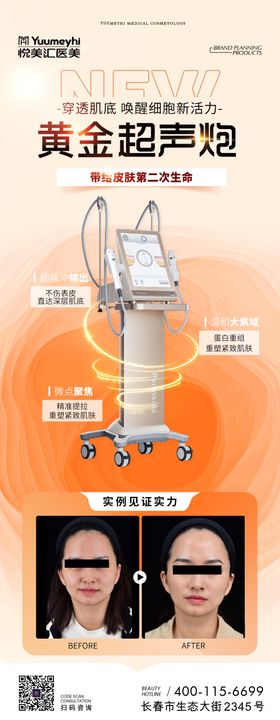 医美黄金超声炮海报