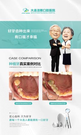 口腔种植牙案例对比海报