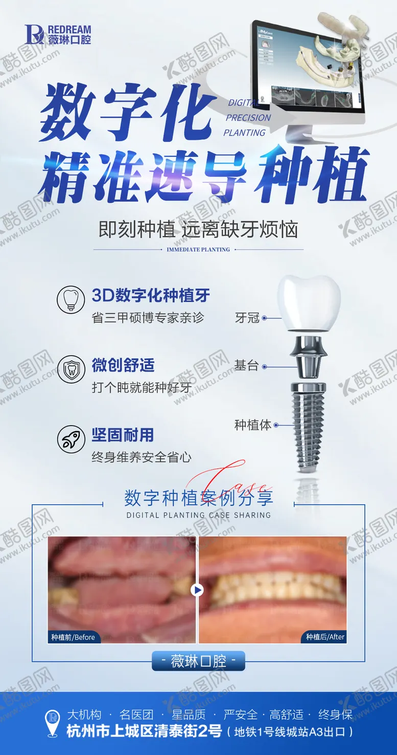 编号：35877712031410342326【酷图网】源文件下载-口腔数字化种植牙