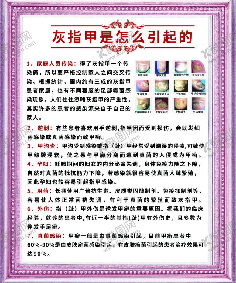 编号：42936911301818323424【酷图网】源文件下载-灰指甲