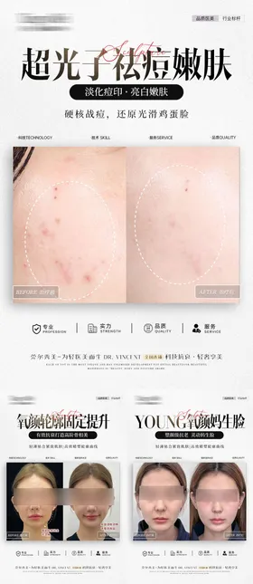医美案例对比海报超光子祛痘整形幼态脸宣传