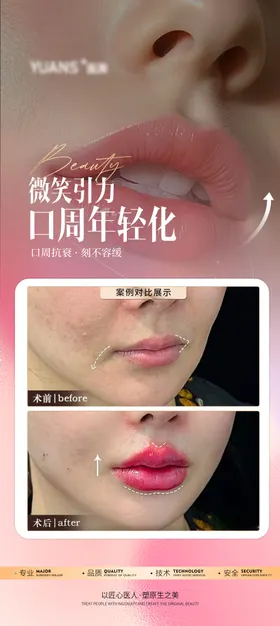 医美口周案例对比图