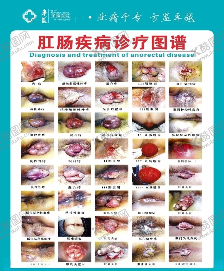 编号：82888410140410492490【酷图网】源文件下载-肛肠疾病图谱
