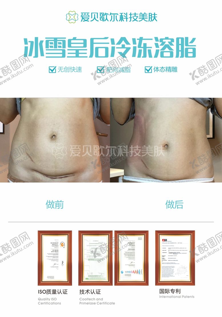 编号：53550012250154238112【酷图网】源文件下载-冷冻溶脂瘦身海报