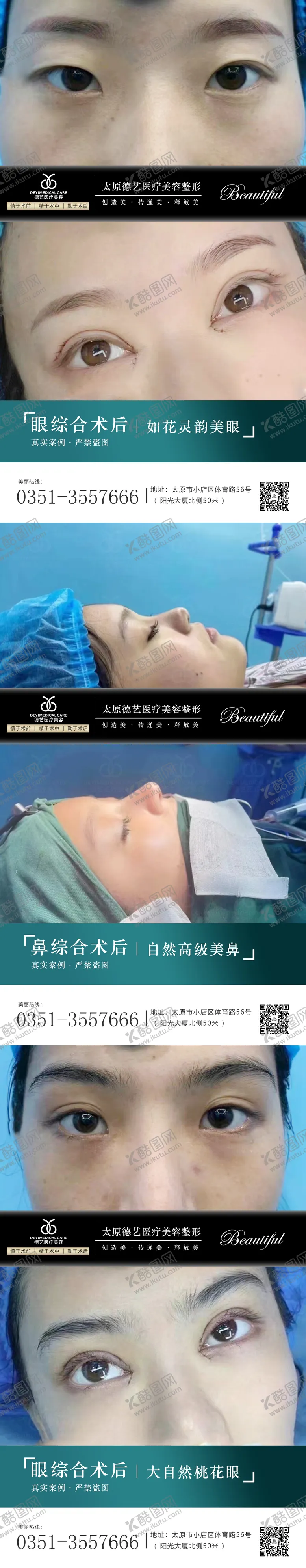 编号：35616612050239025379【酷图网】源文件下载-医美案例对比系列海报