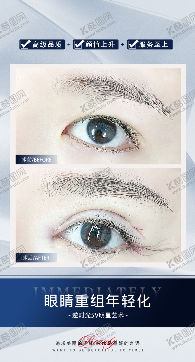 编号：24473001141322398203【酷图网】源文件下载-双眼皮案例对比海报