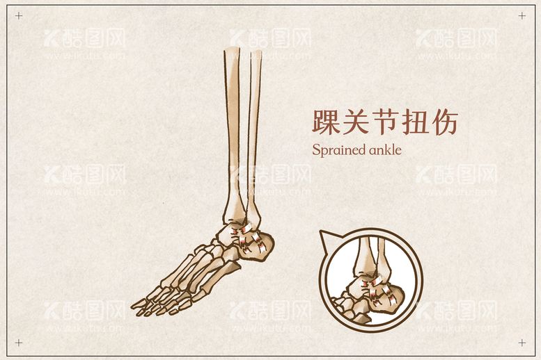 编号：96502809171644197594【酷图网】源文件下载-髋关节扭伤