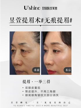 医美整形医院案例对比海报