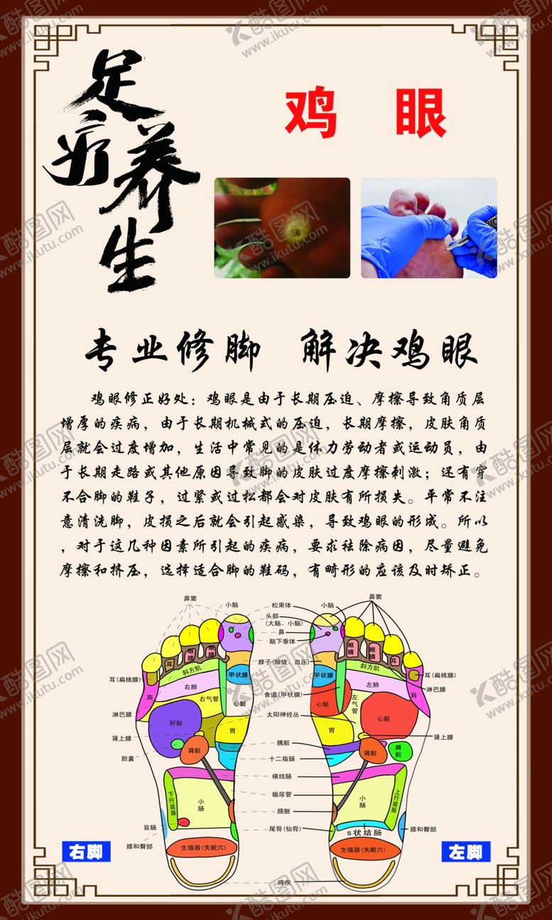 编号：16109109161541122564【酷图网】源文件下载-鸡眼