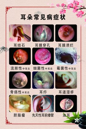 耳朵常见疾病