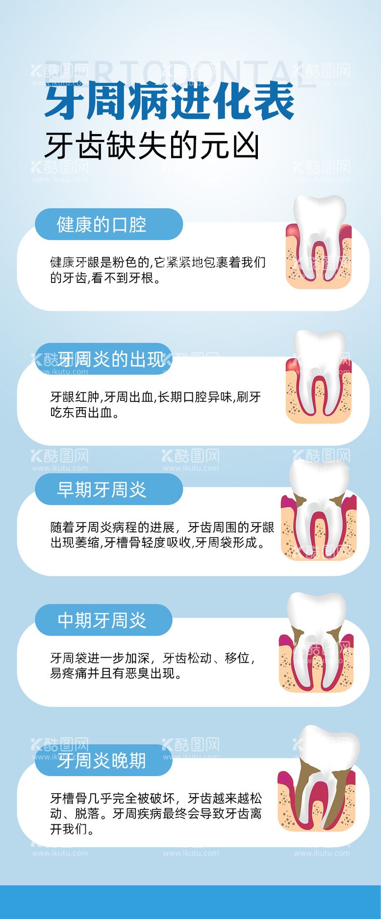 编号：97546811280925526575【酷图网】源文件下载-牙周病牙周炎