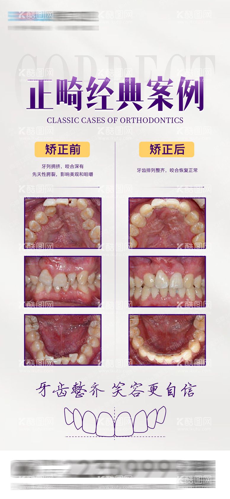 编号：47482311182336409562【酷图网】源文件下载-医美口腔正畸案例对比海报