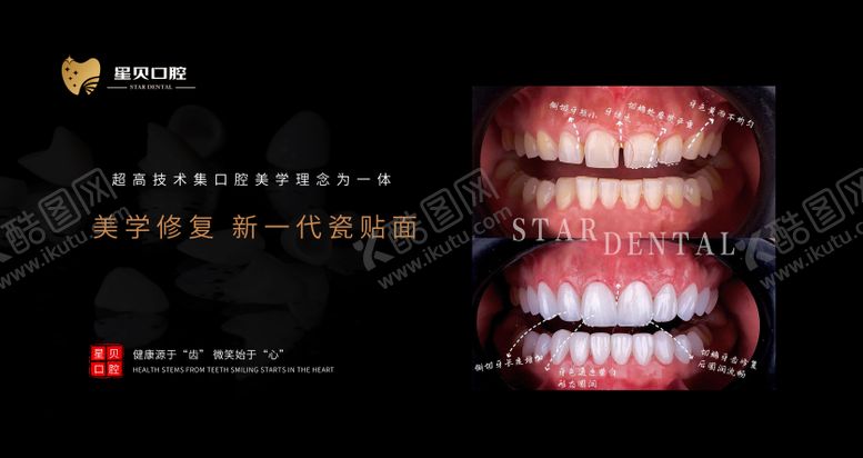 编号：81593609072328266047【酷图网】源文件下载-口腔宣传海报