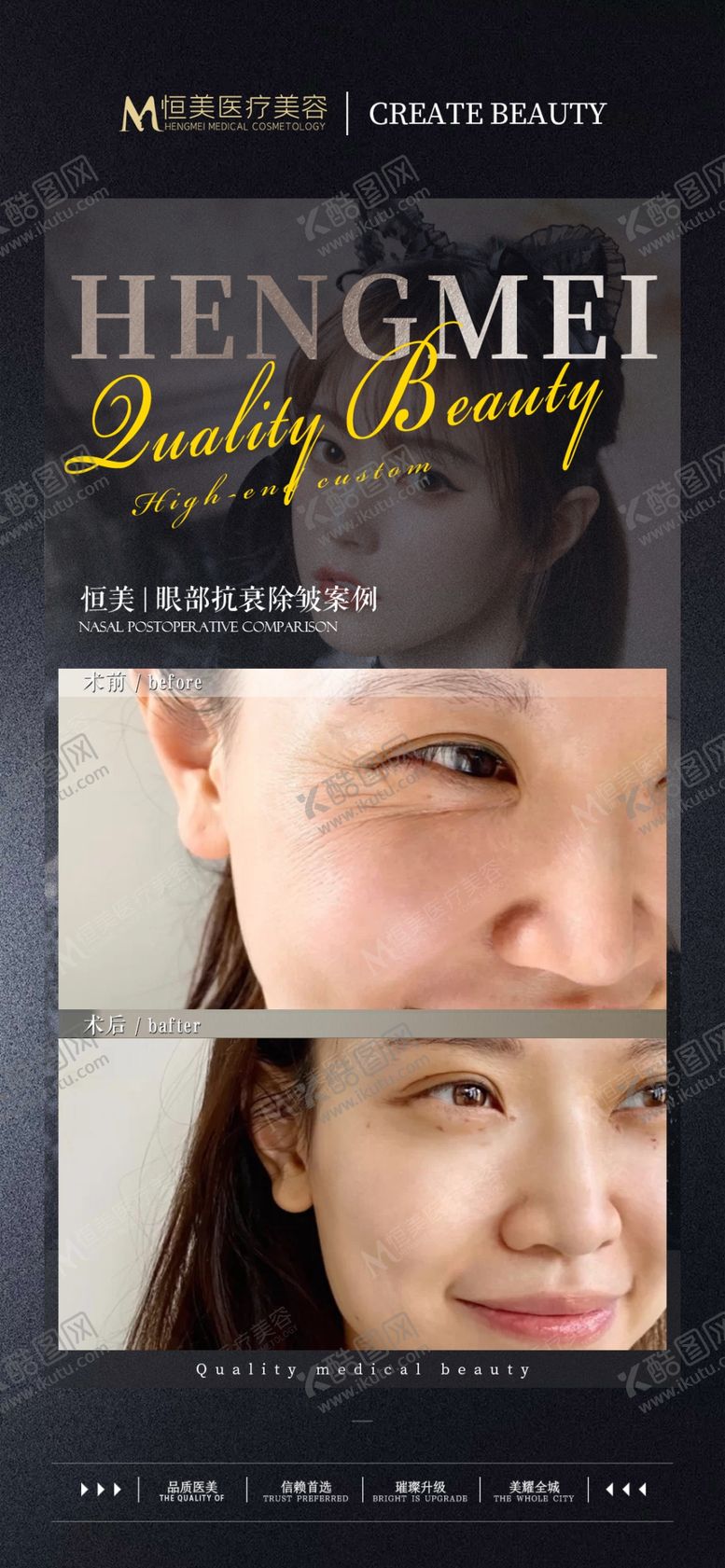 编号：32929001260234249858【酷图网】源文件下载-医美案例对比
