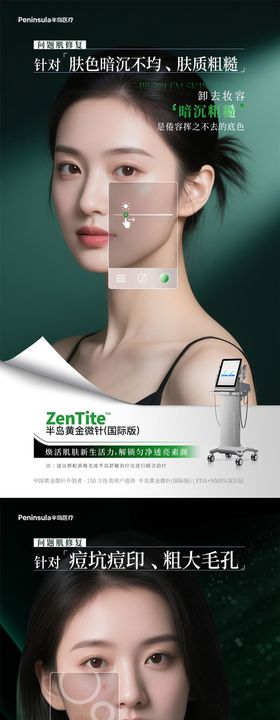 半岛大超炮黄金微针