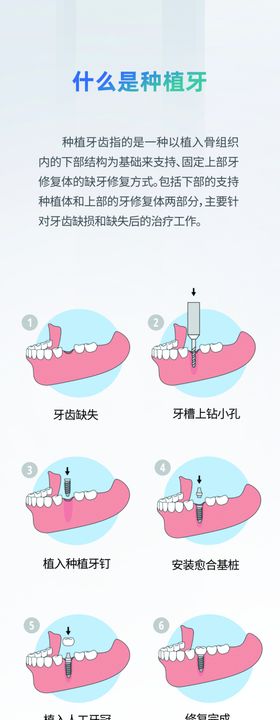 种植牙挂画