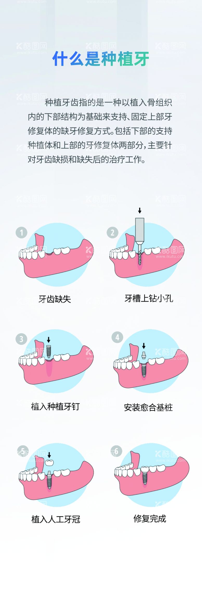 编号：24722511280242561137【酷图网】源文件下载-种植牙挂画