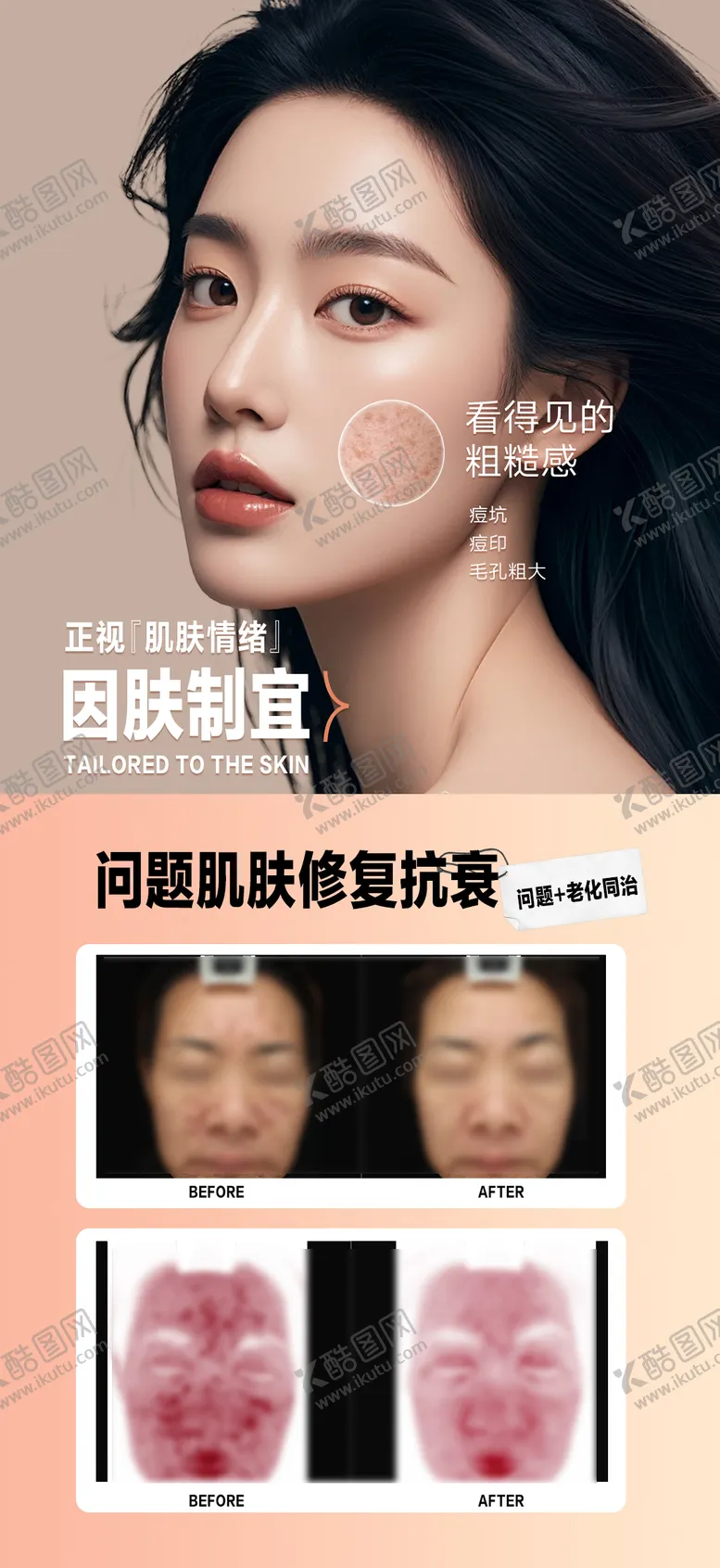 编号：95642706261747099323【酷图网】源文件下载-祛斑祛痘案例