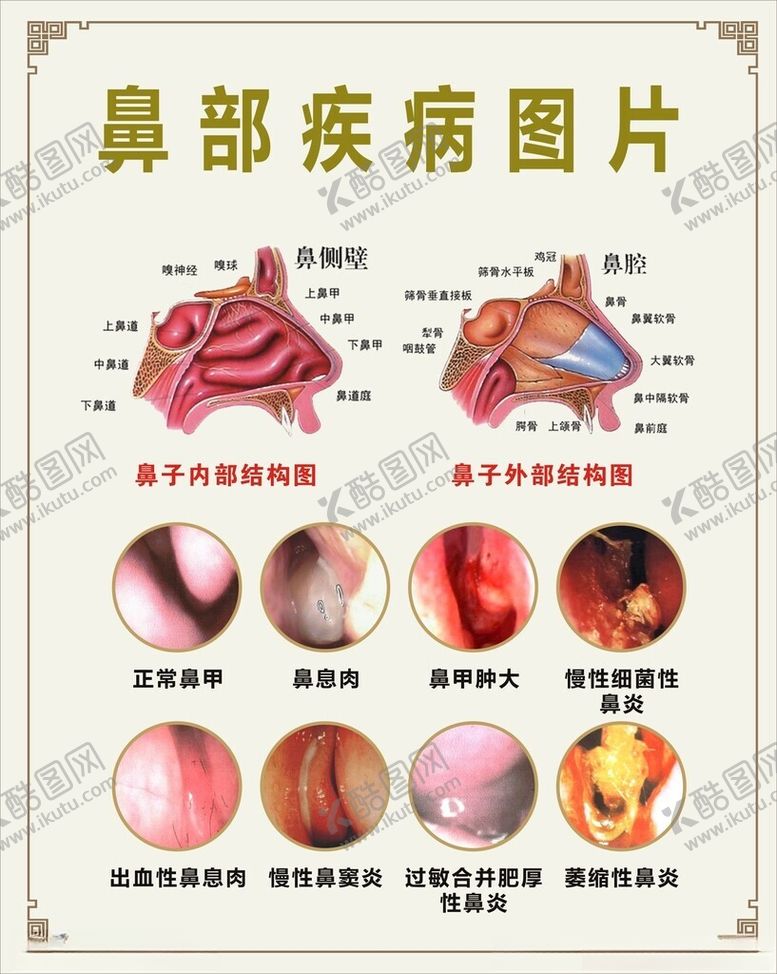 编号：10049701260958029700【酷图网】源文件下载-鼻部疾病图片鼻窦炎