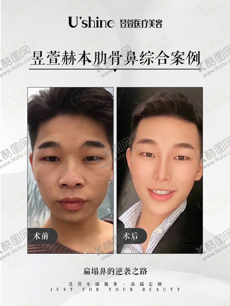 编号：17524505140133257315【酷图网】源文件下载-医美整形医院案例对比海报
