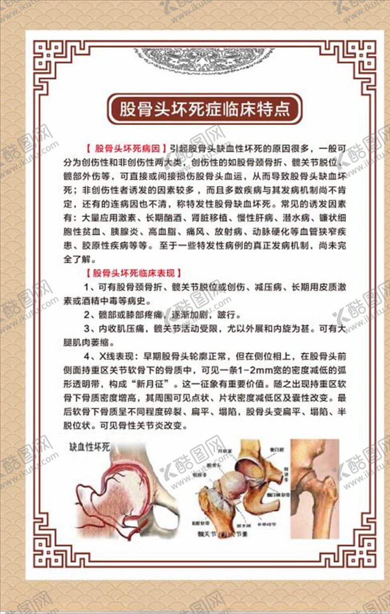 编号：52028205032154372077【酷图网】源文件下载-股骨头坏死