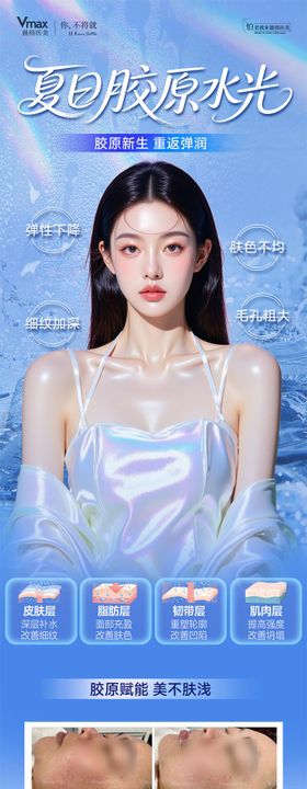 夏日胶原水光案例抗衰胶原蛋白医美海报