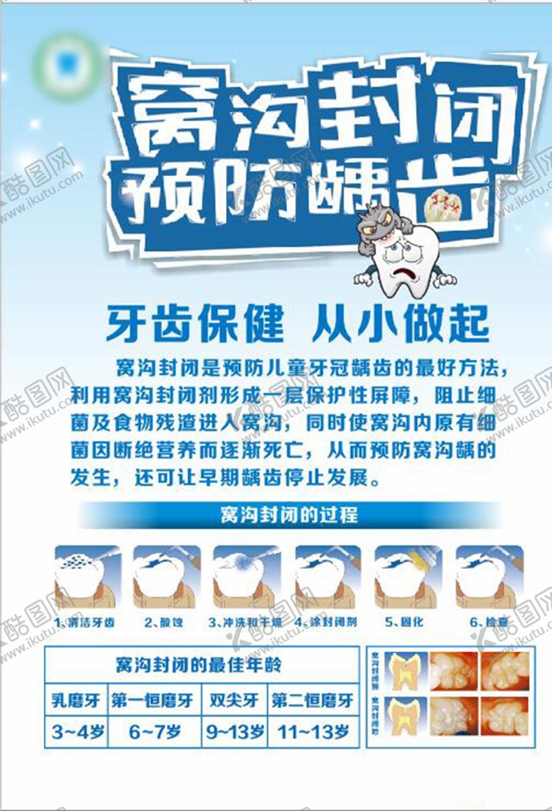 编号：92670311012231422280【酷图网】源文件下载-窝沟封闭