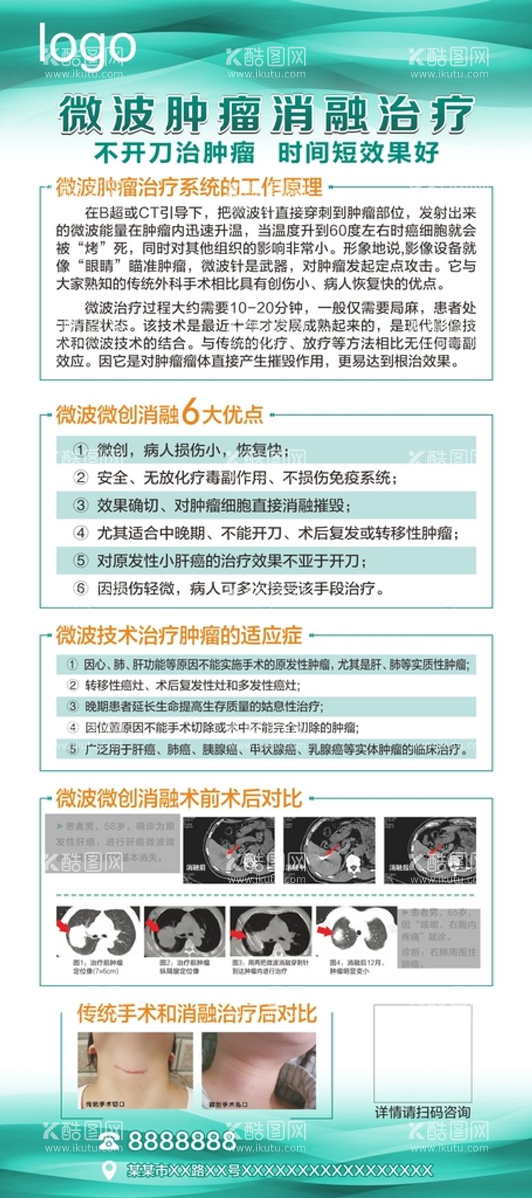 编号：98904610300225088161【酷图网】源文件下载-肿瘤消融