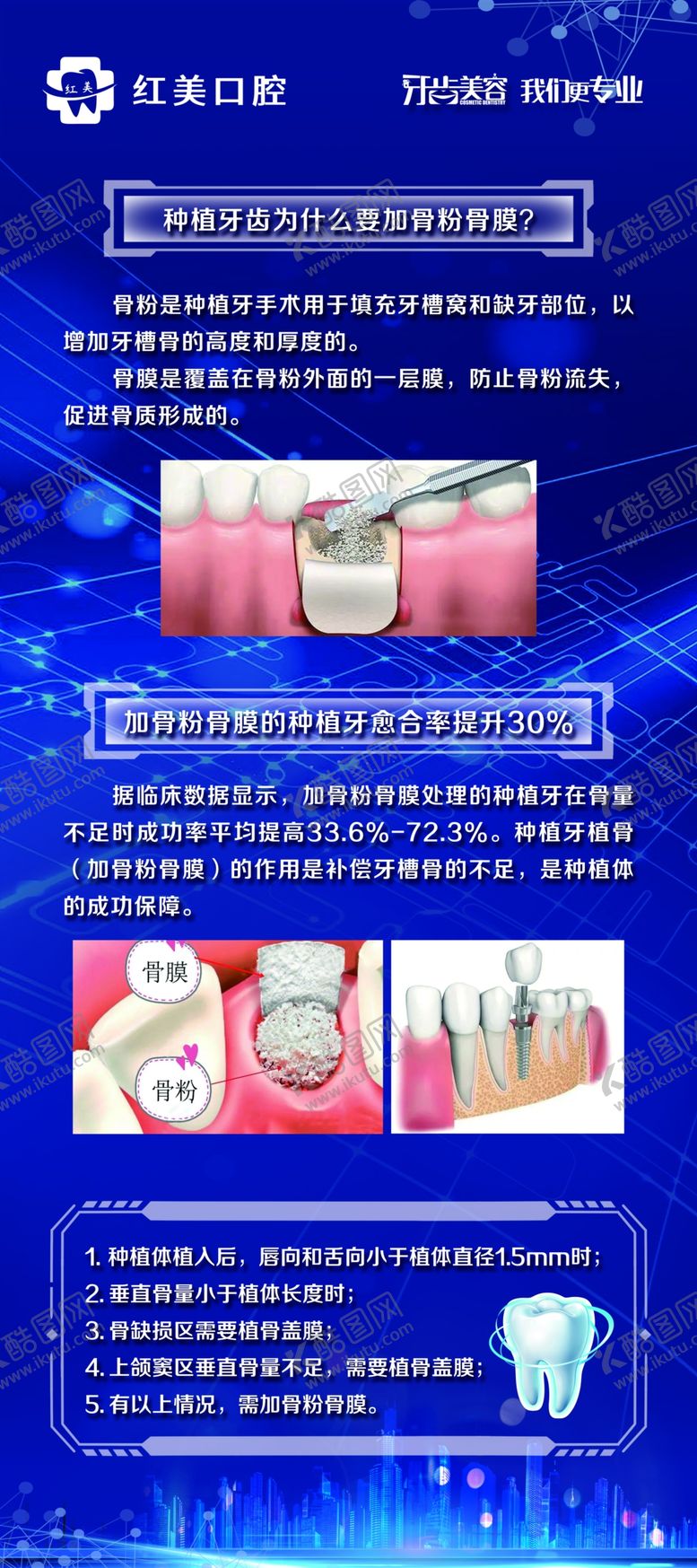 编号：99337302130347152932【酷图网】源文件下载-牙齿种植展架