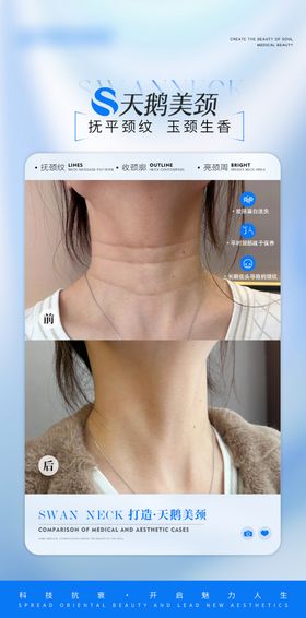 医美颈部抗衰案例对比海报