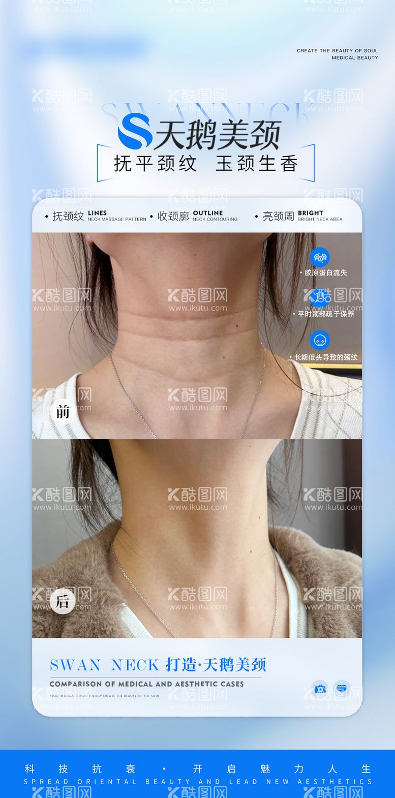 编号：58123112121553493056【酷图网】源文件下载-医美颈部抗衰案例对比海报