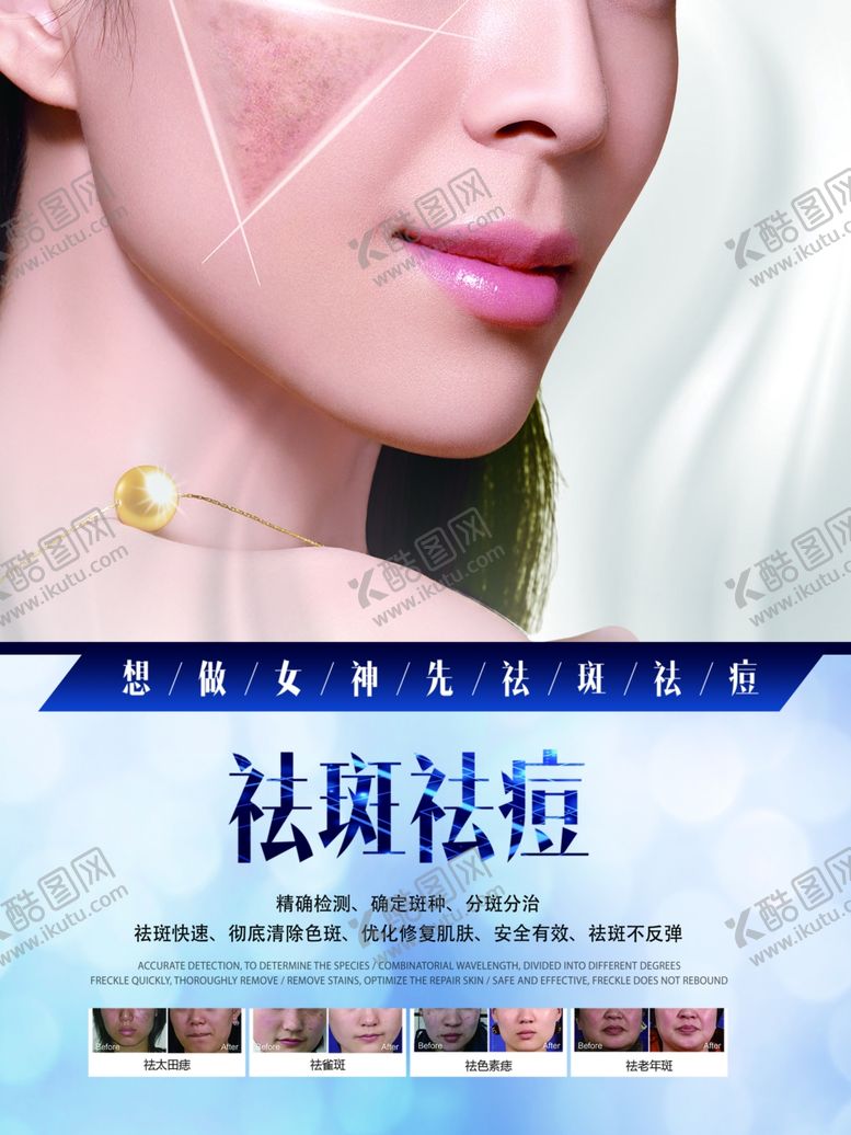编号：25891310030100003553【酷图网】源文件下载-祛青春痘海报广告朋友圈图