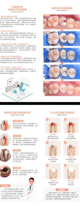 根管治疗三折页