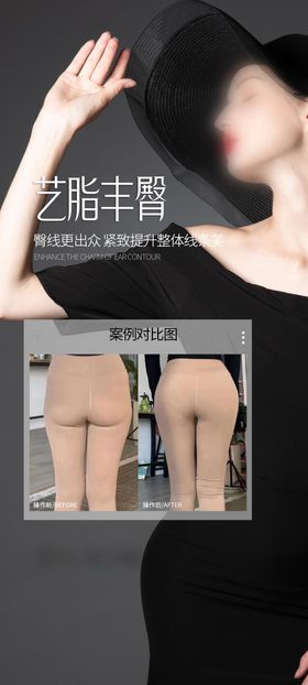 医美丰臀案例海报