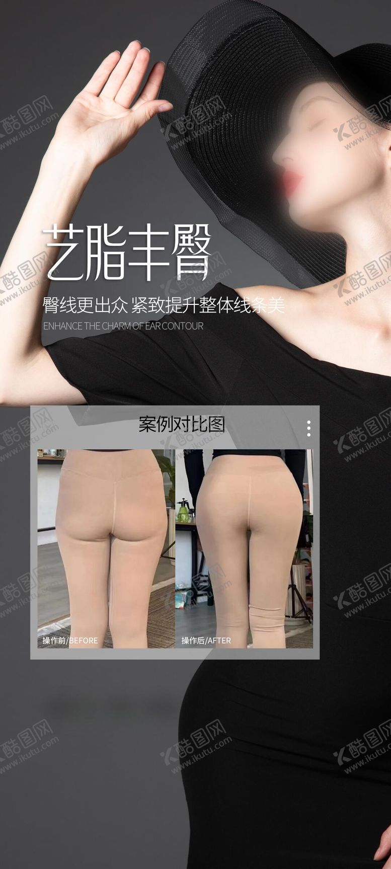 编号：17757305181527297796【酷图网】源文件下载-医美丰臀案例海报