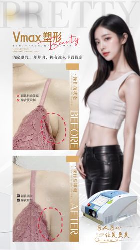 副乳小颜术