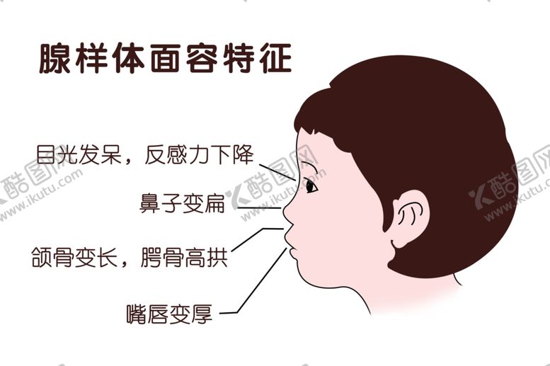 编号：31506902210422465202【酷图网】源文件下载-腺样体面容特征