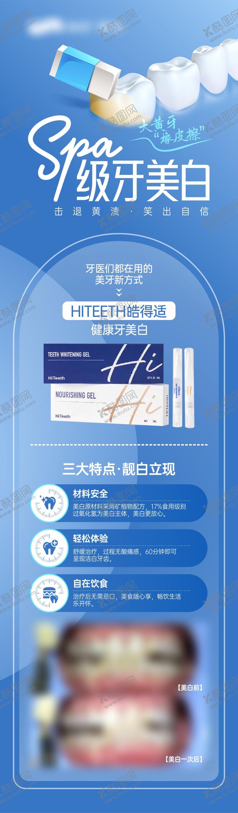 编号：49961705161403176799【酷图网】源文件下载-美白牙齿 