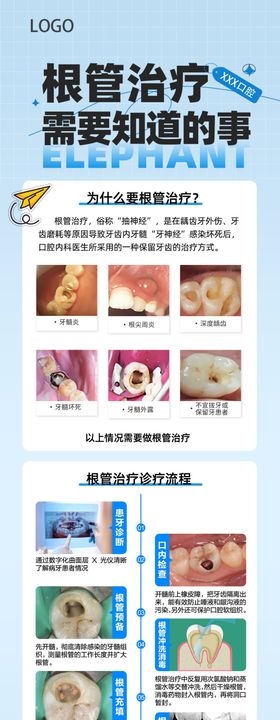 牙齿根管治疗