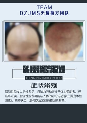 植发海报