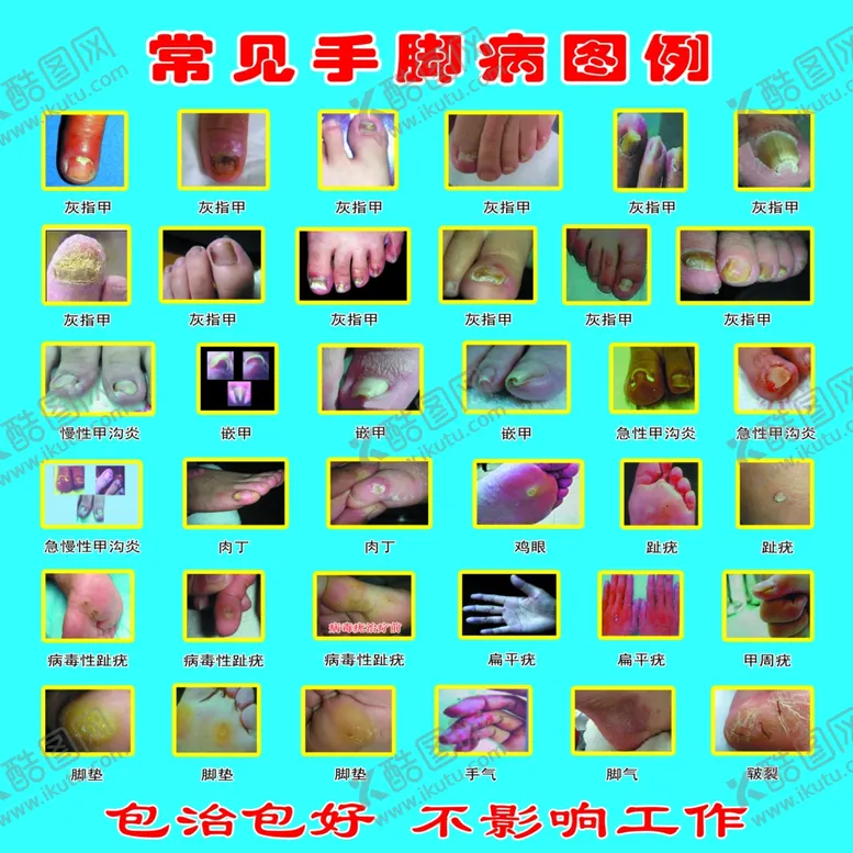编号：86456502231357413130【酷图网】源文件下载-常见手脚病图例