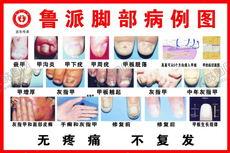 编号：49363405060220599932【酷图网】源文件下载-脚部病例图