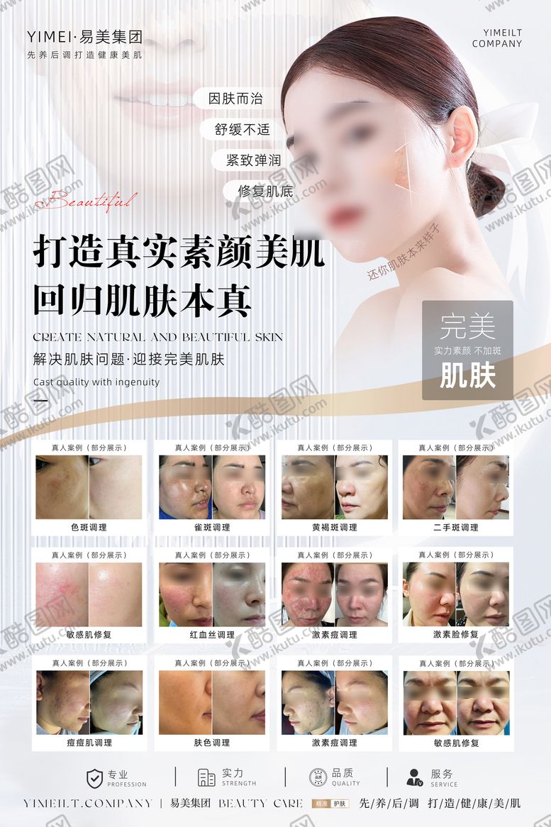 编号：54314503011757502084【酷图网】源文件下载-医美祛斑案例对比宣传海报