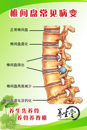 椎间盘病变图