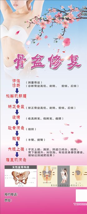 骨盆修複
