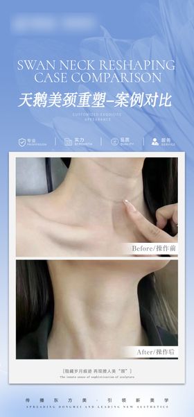 医美春天抗衰案例对比海报