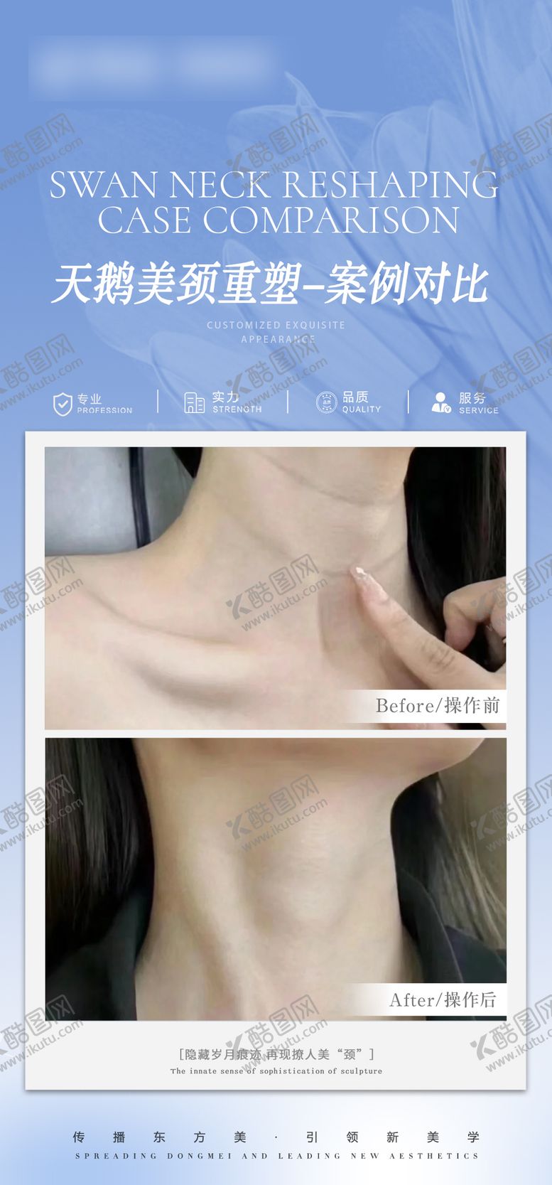 编号：95169205181452522000【酷图网】源文件下载-医美颈部抗衰案例对比海报