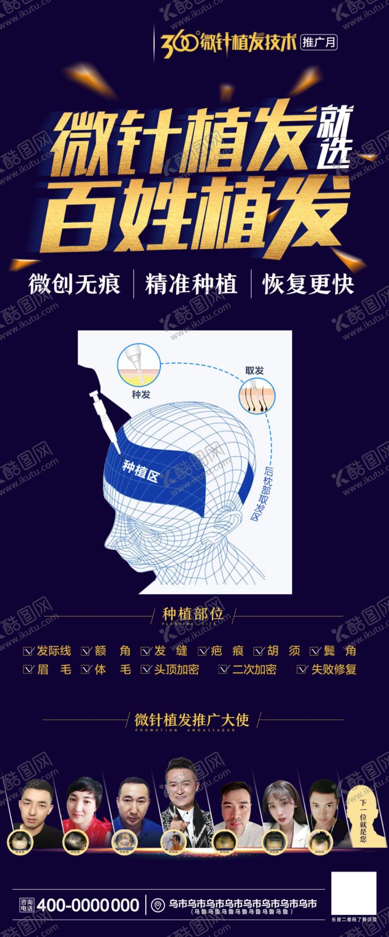 编号：48106111170356303306【酷图网】源文件下载-微针植发
